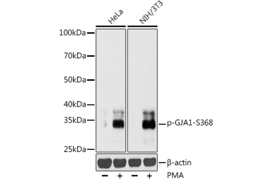 Western Blot - Anti-Connexin 43 / GJA1 (phospho Ser368) Antibody (A16593) - Antibodies.com
