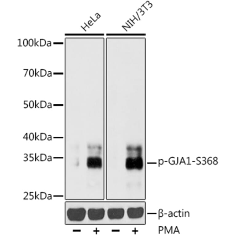 Western Blot - Anti-Connexin 43 / GJA1 (phospho Ser368) Antibody (A16593) - Antibodies.com