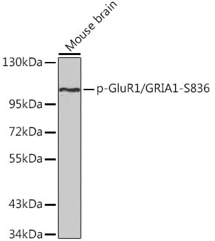 Glutamate Receptor 1 (AMPA subtype) (pSer836) Antibody (A16594)