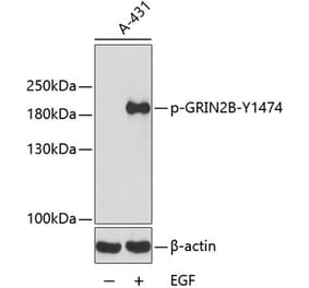 Western Blot - Anti-NMDAR2B (phospho Tyr1474) Antibody (A16595) - Antibodies.com