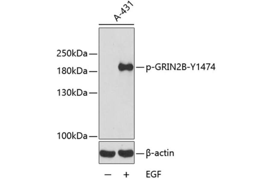 Western Blot - Anti-NMDAR2B (phospho Tyr1474) Antibody (A16595) - Antibodies.com