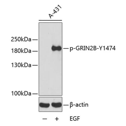 Western Blot - Anti-NMDAR2B (phospho Tyr1474) Antibody (A16595) - Antibodies.com
