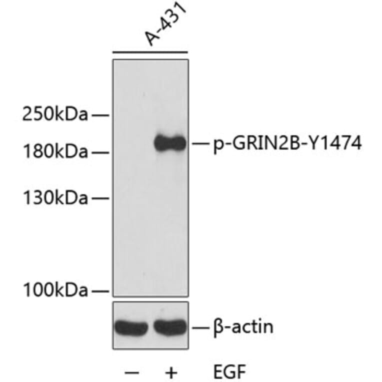 Western Blot - Anti-NMDAR2B (phospho Tyr1474) Antibody (A16595) - Antibodies.com