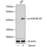 Western Blot - Anti-GSK3B (phospho S9) Antibody (AP0358) - Antibodies.com