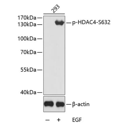 Western Blot - Anti-HDAC4 (phospho Ser632) Antibody (A16597) - Antibodies.com