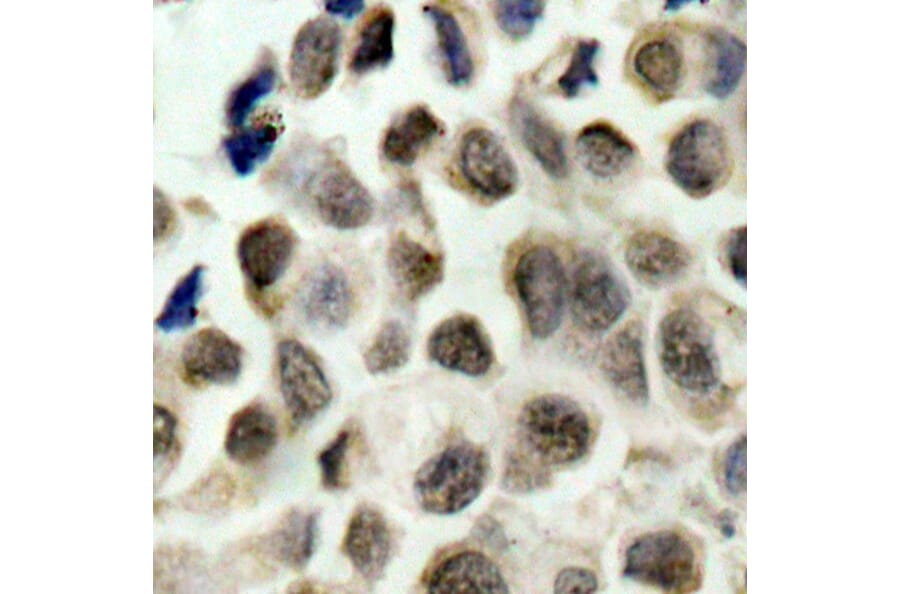 Immunohistochemistry - Anti-HDAC8 (phospho Ser39) Antibody (A16598) - Antibodies.com