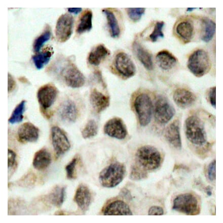 Immunohistochemistry - Anti-HDAC8 (phospho Ser39) Antibody (A16598) - Antibodies.com