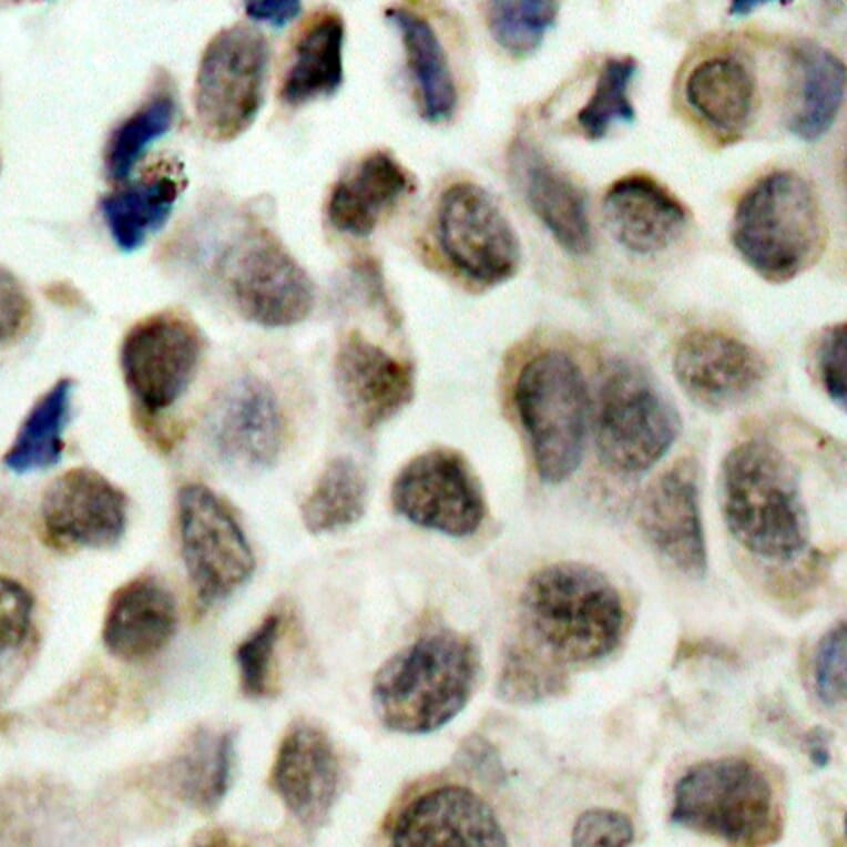 Immunohistochemistry - Anti-HDAC8 (phospho Ser39) Antibody (A16598) - Antibodies.com