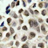 Immunohistochemistry - Anti-HDAC8 (phospho Ser39) Antibody (A16598) - Antibodies.com