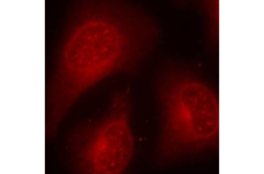 Immunofluorescence - Anti-HDAC8 (phospho Ser39) Antibody (A16598) - Antibodies.com