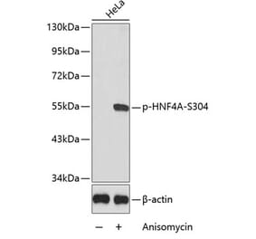 Western Blot - Anti-HNF-4-alpha (phospho Ser304) Antibody (A16600) - Antibodies.com