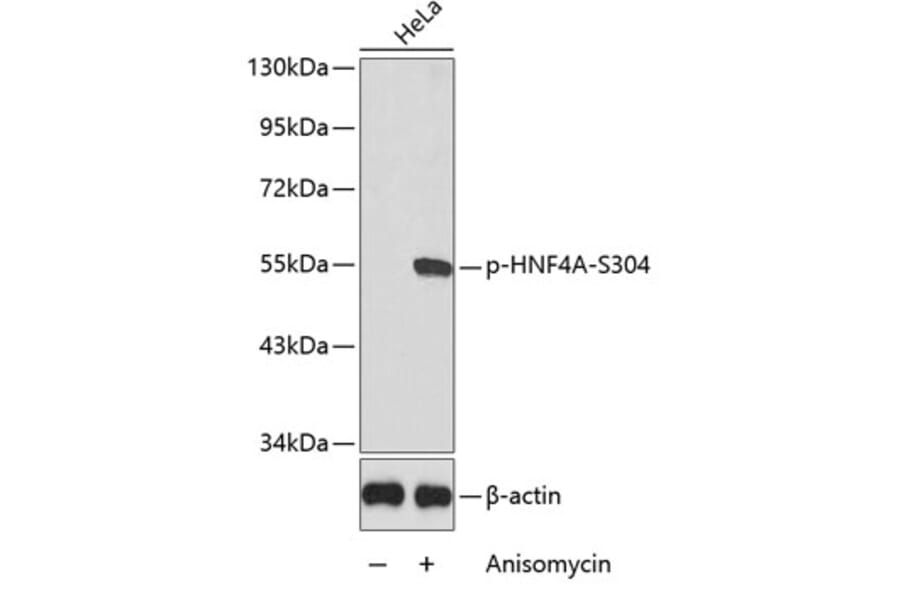 Western Blot - Anti-HNF-4-alpha (phospho Ser304) Antibody (A16600) - Antibodies.com