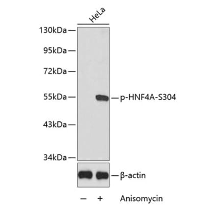 Western Blot - Anti-HNF-4-alpha (phospho Ser304) Antibody (A16600) - Antibodies.com