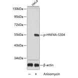 Western Blot - Anti-HNF-4-alpha (phospho Ser304) Antibody (A16600) - Antibodies.com