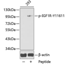 Western Blot - Anti-IGF1 Receptor (phospho Tyr1161) Antibody (A16601) - Antibodies.com