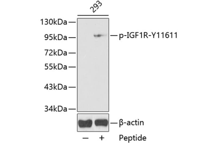 Western Blot - Anti-IGF1 Receptor (phospho Tyr1161) Antibody (A16601) - Antibodies.com