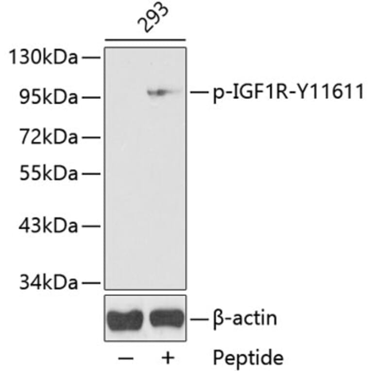 Western Blot - Anti-IGF1 Receptor (phospho Tyr1161) Antibody (A16601) - Antibodies.com