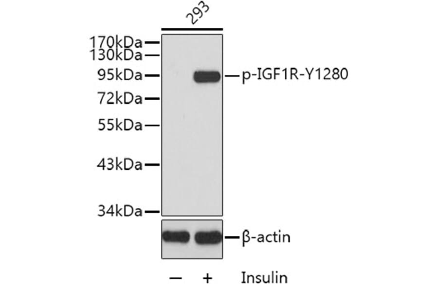 Western Blot - Anti-IGF1 Receptor (phospho Tyr1280) Antibody (A16602) - Antibodies.com