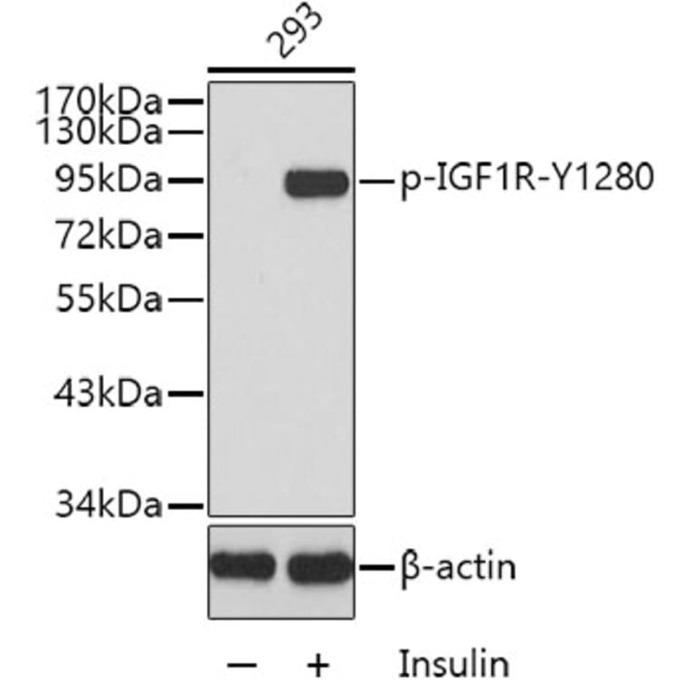 Western Blot - Anti-IGF1 Receptor (phospho Tyr1280) Antibody (A16602) - Antibodies.com