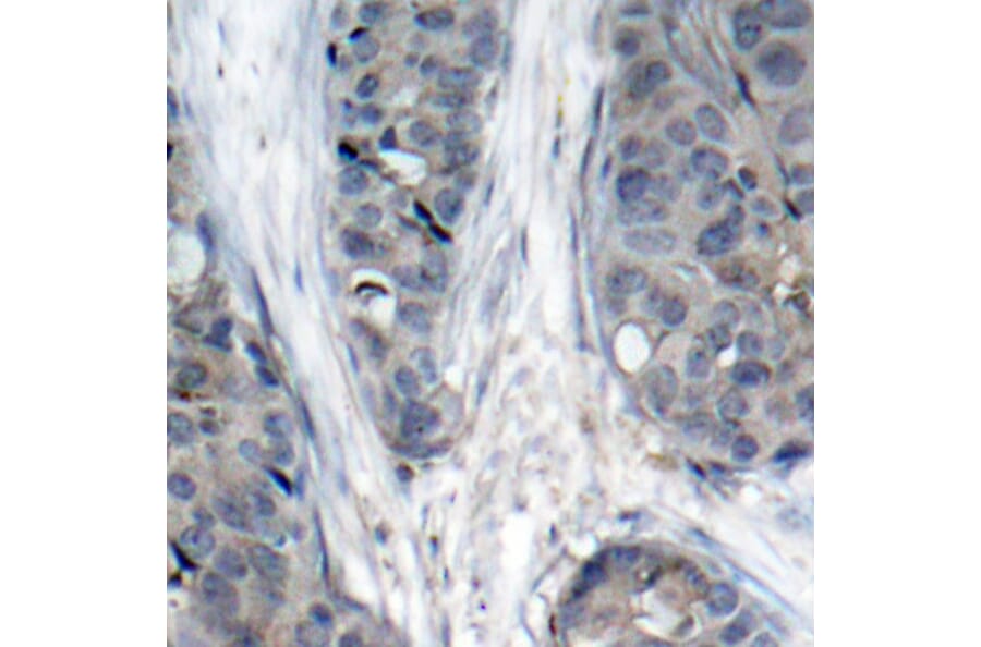 Immunohistochemistry - Anti-IRS1 (phospho S307) Antibody (AP0371) - Antibodies.com
