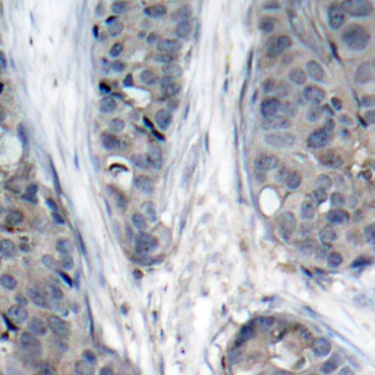 Immunohistochemistry - Anti-IRS1 (phospho S307) Antibody (AP0371) - Antibodies.com