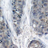 Immunohistochemistry - Anti-IRS1 (phospho S307) Antibody (AP0371) - Antibodies.com