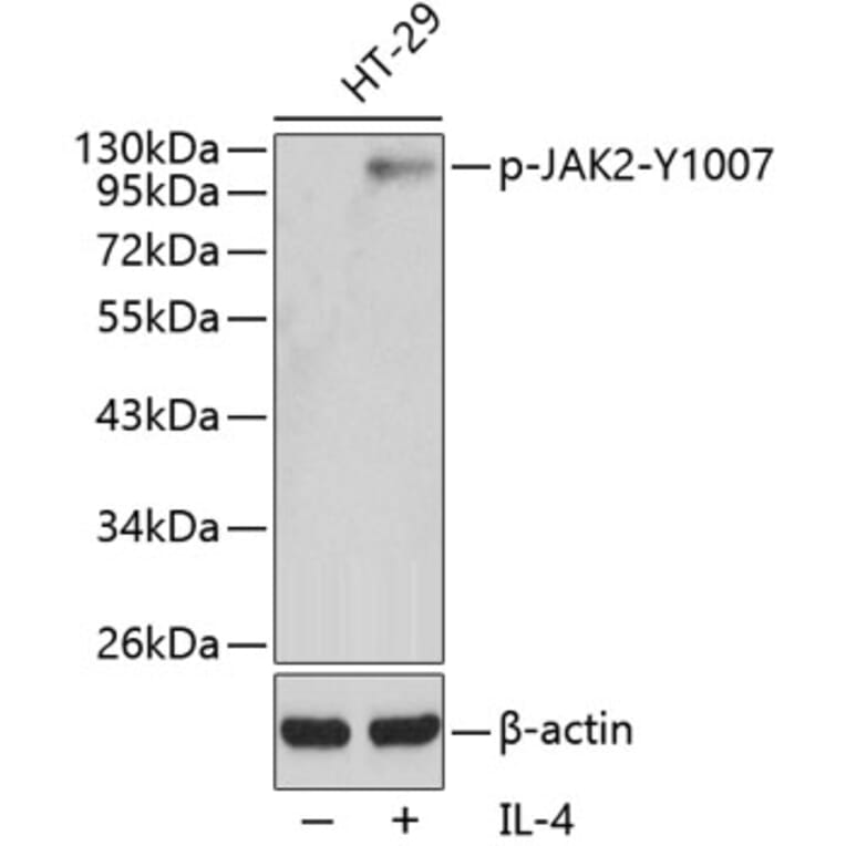 Western Blot - Anti-JAK2 (phospho Tyr1007) Antibody (A16605) - Antibodies.com