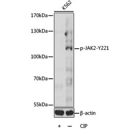 Western Blot - Anti-JAK2 (phospho Tyr221) Antibody (A16606) - Antibodies.com