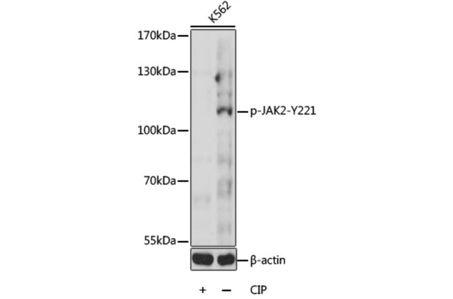 Western Blot - Anti-JAK2 (phospho Tyr221) Antibody (A16606) - Antibodies.com