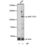 Western Blot - Anti-JAK2 (phospho Tyr221) Antibody (A16606) - Antibodies.com