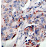 Immunohistochemistry - Anti-JAK2 (phospho Tyr221) Antibody (A16606) - Antibodies.com