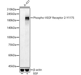 Western Blot - Anti-VEGF Receptor 2 (phospho Tyr1175) Antibody (A16614) - Antibodies.com