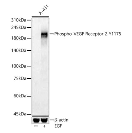 Western Blot - Anti-VEGF Receptor 2 (phospho Tyr1175) Antibody (A16614) - Antibodies.com