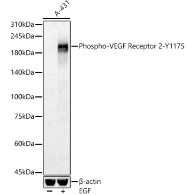 Western Blot - Anti-VEGF Receptor 2 (phospho Tyr1175) Antibody (A16614) - Antibodies.com