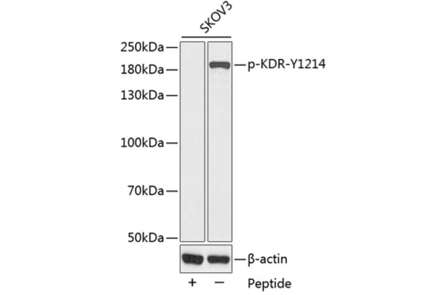 Western Blot - Anti-KDR (phospho Y1214) Antibody (AP0383) - Antibodies.com