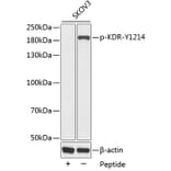 Western Blot - Anti-KDR (phospho Y1214) Antibody (AP0383) - Antibodies.com