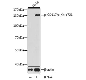 Western Blot - Anti-c-Kit (phospho Tyr721) Antibody (A16616) - Antibodies.com