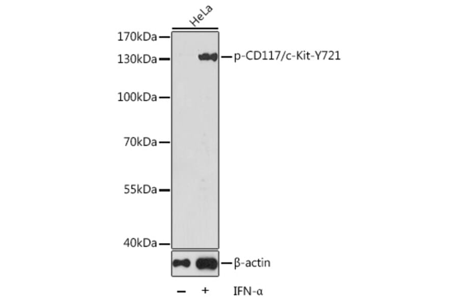 Western Blot - Anti-c-Kit (phospho Tyr721) Antibody (A16616) - Antibodies.com
