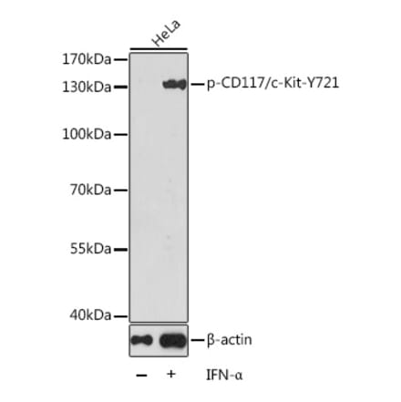 Western Blot - Anti-c-Kit (phospho Tyr721) Antibody (A16616) - Antibodies.com