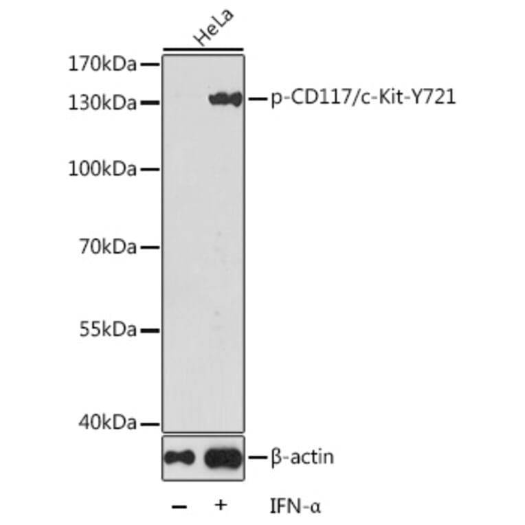 Western Blot - Anti-c-Kit (phospho Tyr721) Antibody (A16616) - Antibodies.com