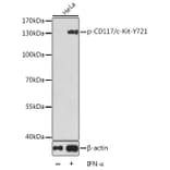 Western Blot - Anti-c-Kit (phospho Tyr721) Antibody (A16616) - Antibodies.com