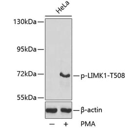 Western Blot - Anti-LIM Kinase 1 (phospho Thr508) Antibody (A16617) - Antibodies.com