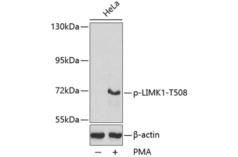 Western Blot - Anti-LIM Kinase 1 (phospho Thr508) Antibody (A16617) - Antibodies.com