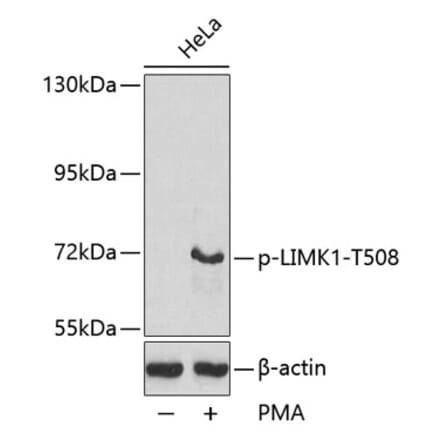 Western Blot - Anti-LIM Kinase 1 (phospho Thr508) Antibody (A16617) - Antibodies.com