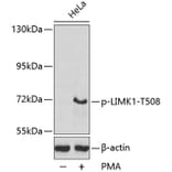 Western Blot - Anti-LIM Kinase 1 (phospho Thr508) Antibody (A16617) - Antibodies.com