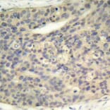 Immunohistochemistry - Anti-LIM Kinase 1 (phospho Thr508) Antibody (A16617) - Antibodies.com