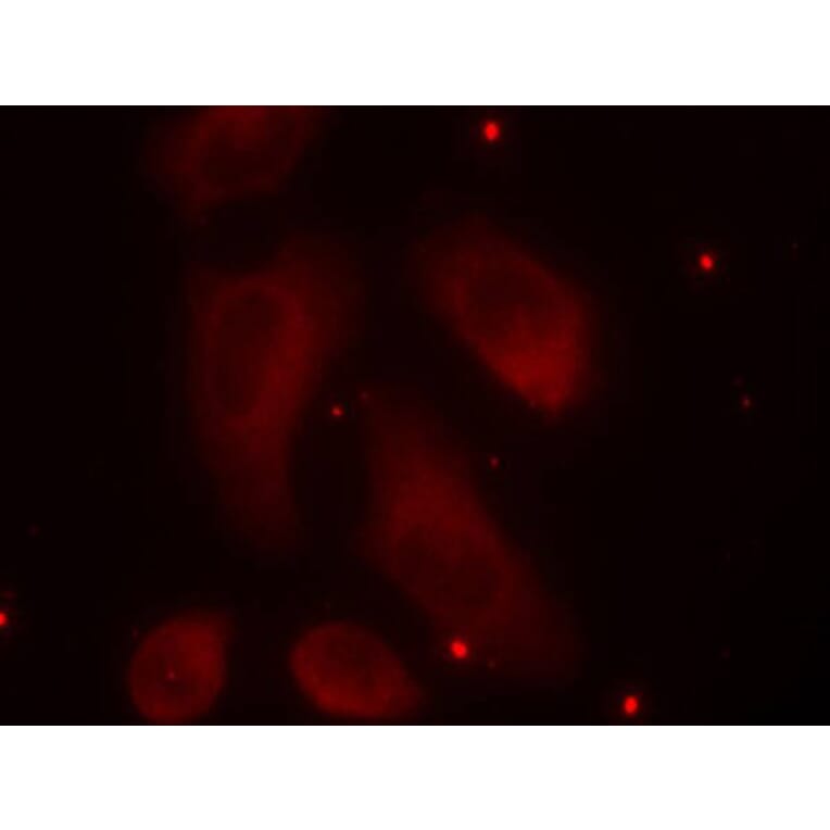 Immunofluorescence - Anti-LIM Kinase 1 (phospho Thr508) Antibody (A16617) - Antibodies.com
