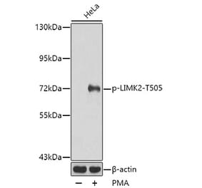 Western Blot - Anti-LIMK2 (phospho Thr505) Antibody (A16618) - Antibodies.com