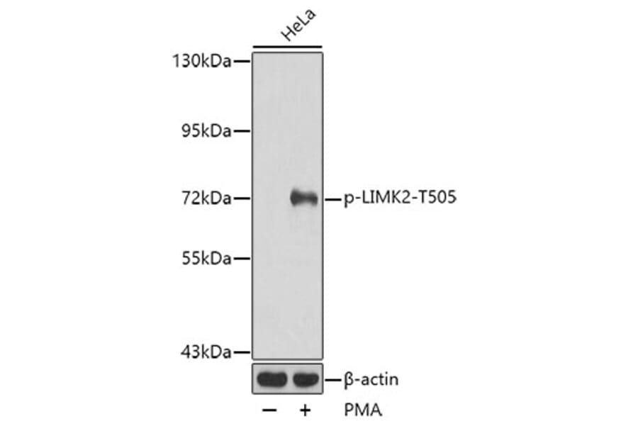 Western Blot - Anti-LIMK2 (phospho Thr505) Antibody (A16618) - Antibodies.com