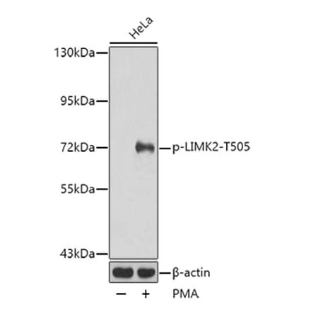 Western Blot - Anti-LIMK2 (phospho Thr505) Antibody (A16618) - Antibodies.com